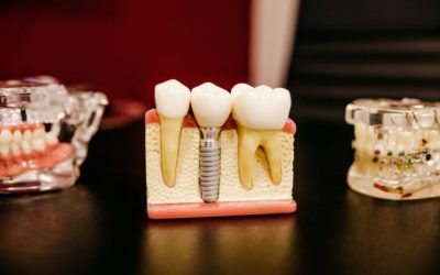Dentist in Stirling | Beechboro | First Impressions