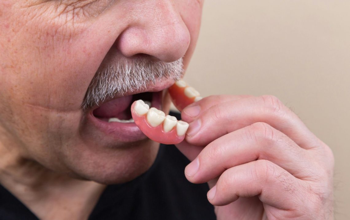 A man puts his denture in place