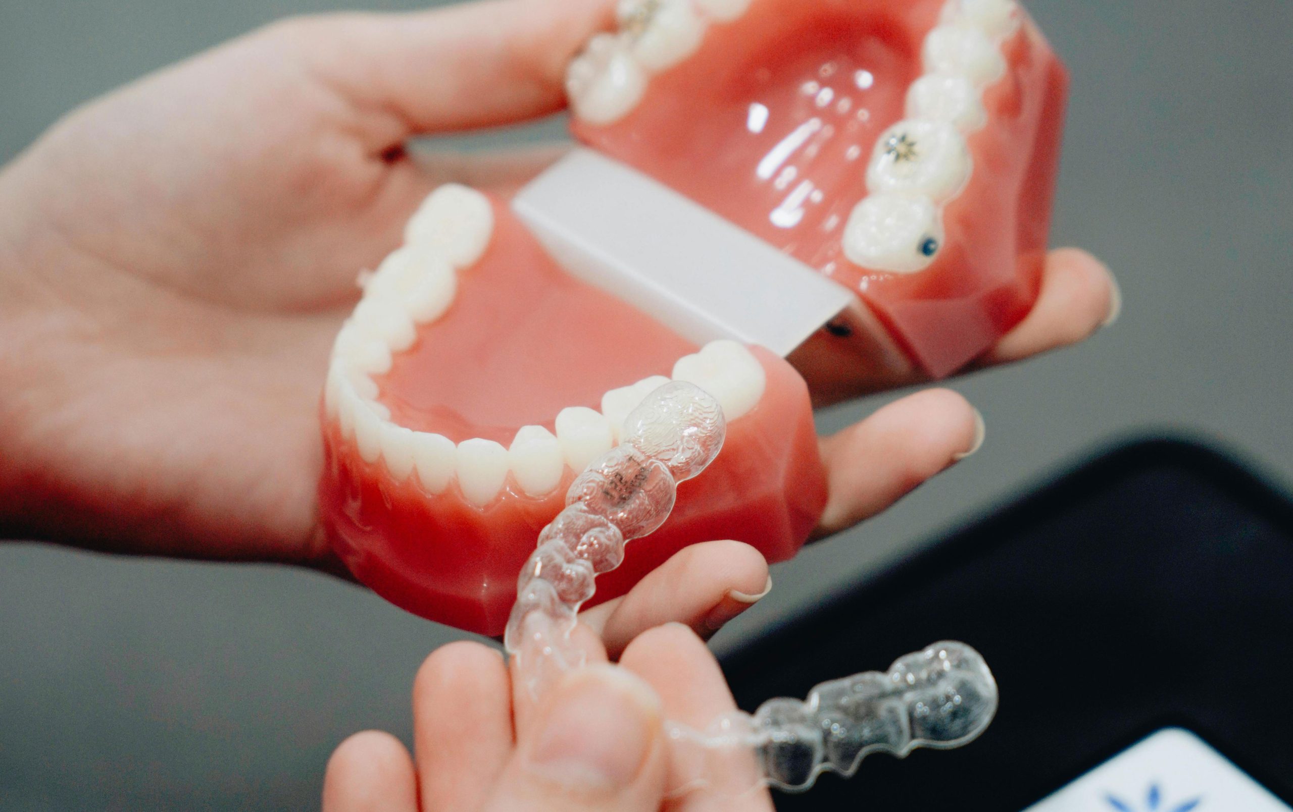 The Long-term Benefits of Invisalign: Why It’s Worth the Investment