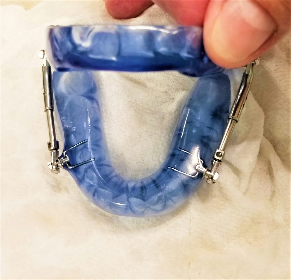 ORAL CARE! MANDIBULAR DEVICE FOR SLEEP APNEA!!