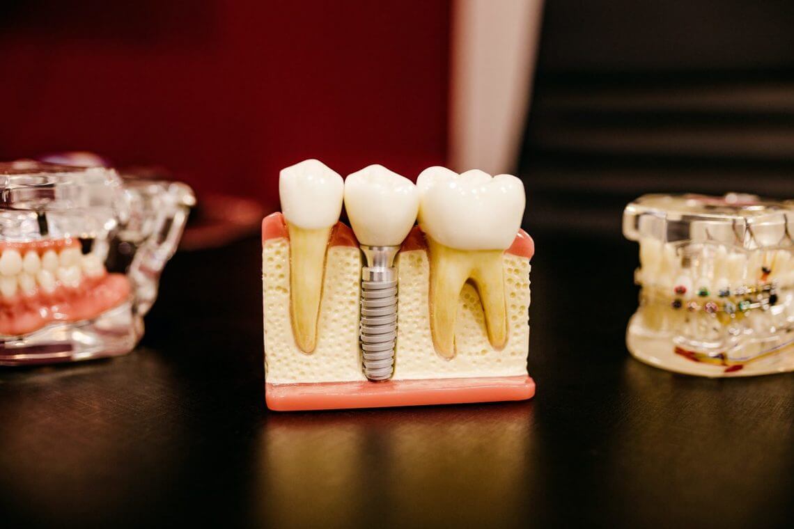 Dentist in Stirling | Beechboro | First Impressions