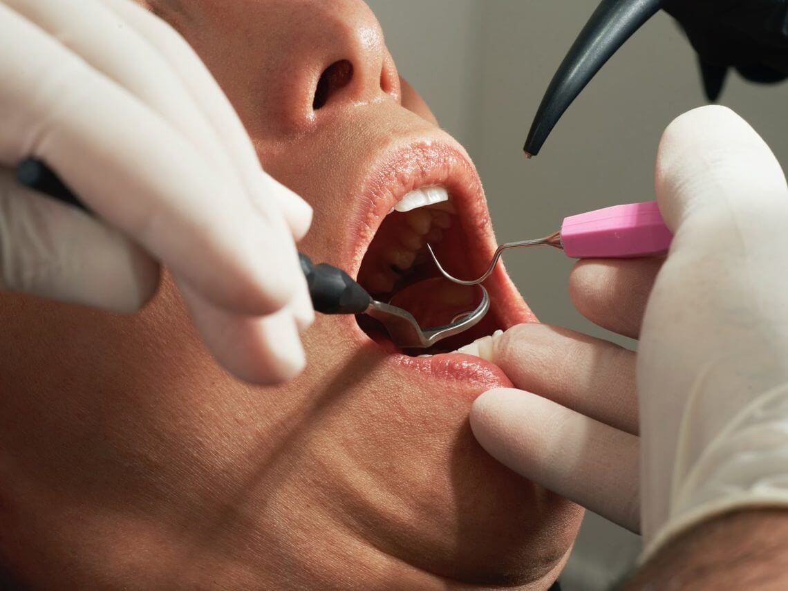 Dentist in Stirling | Beechboro | First Impressions
