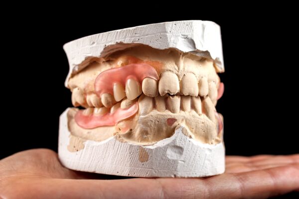 Dental plaster model on a hand