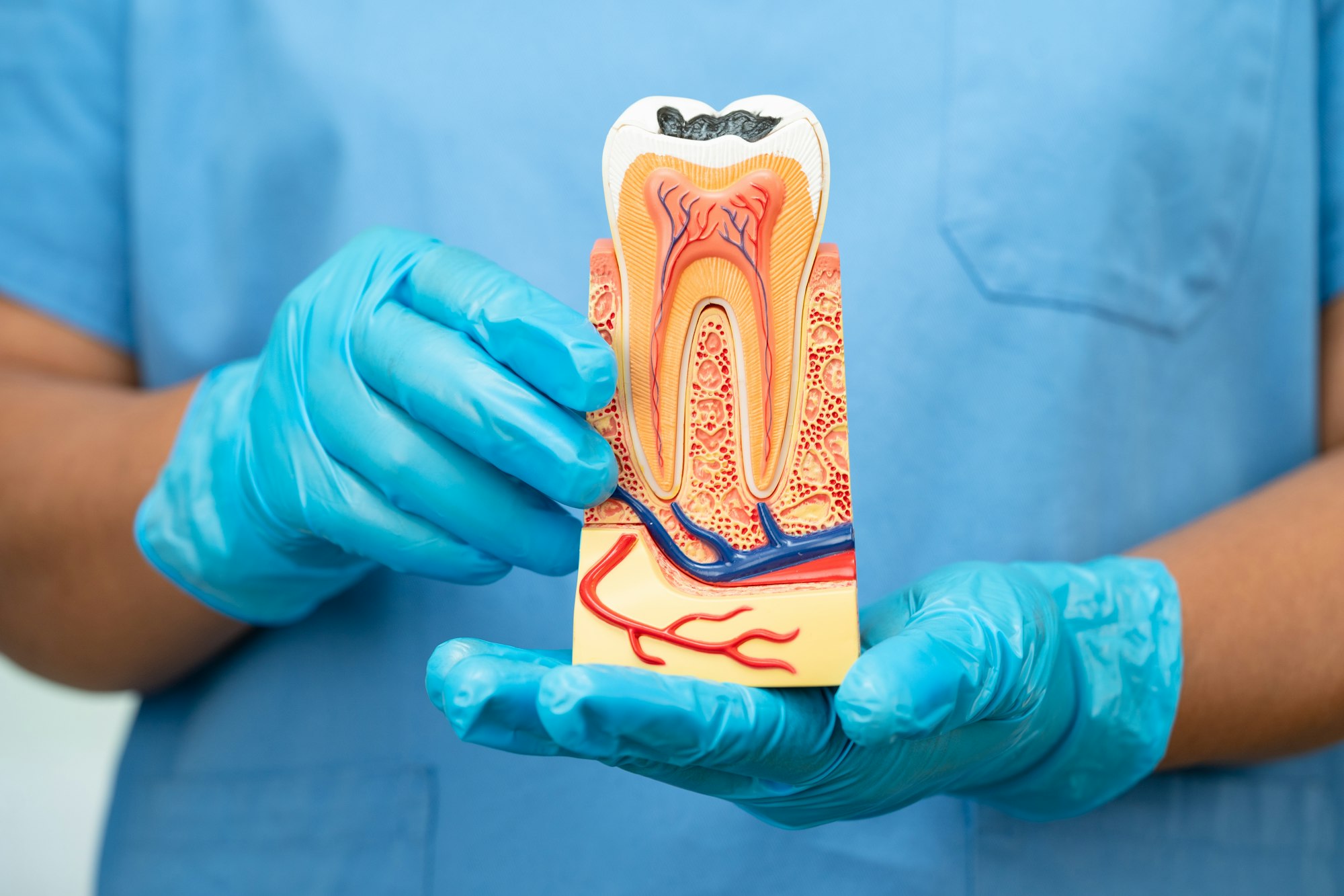 dentist holding dental implant, artificial tooth roots into jaw, root canal of dental