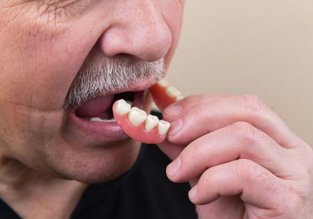 A man puts his denture in place