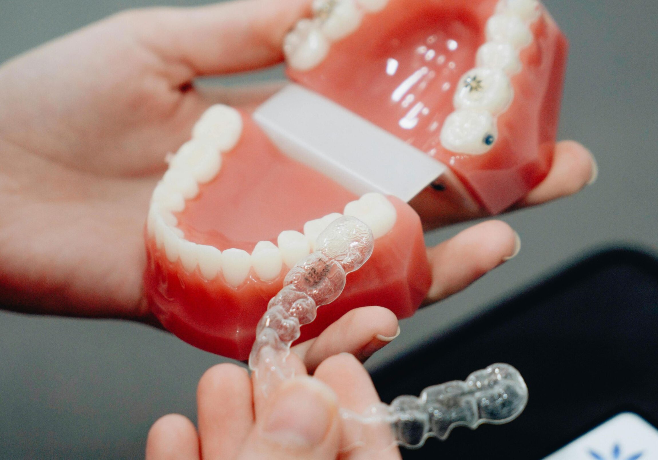invisalign-long-term-benefits