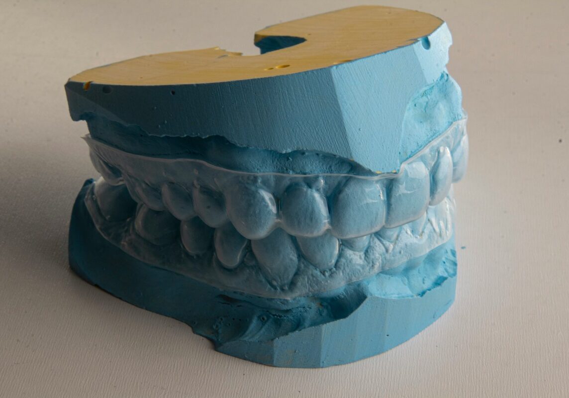 clear Invisalign retainer on a blue mouth mould