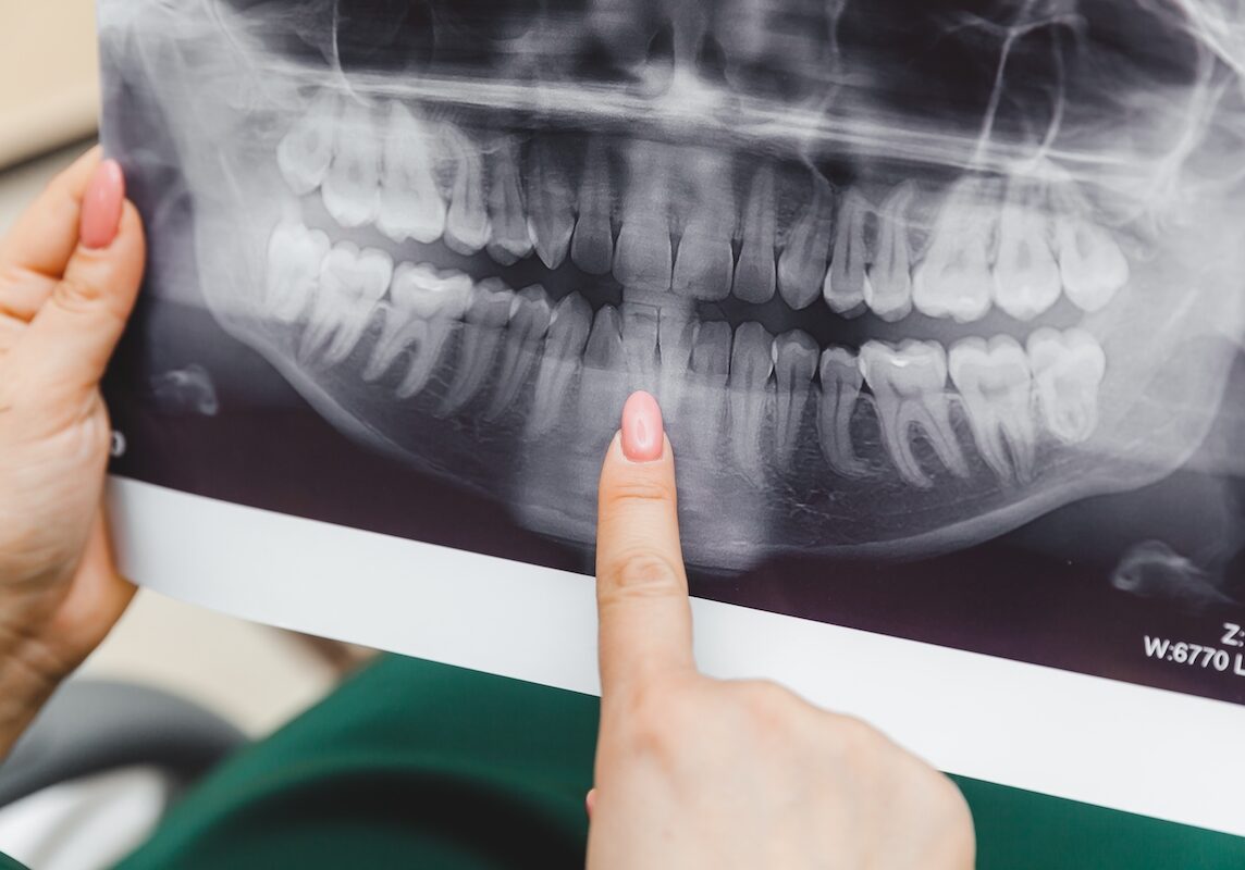 woman holding an x-ray of a patient's set of teeth