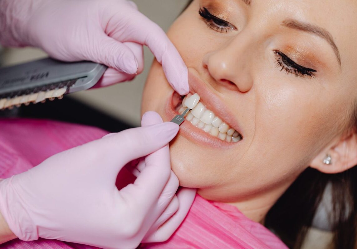 A Dentist Applying a Veneer Tooth on a Patient