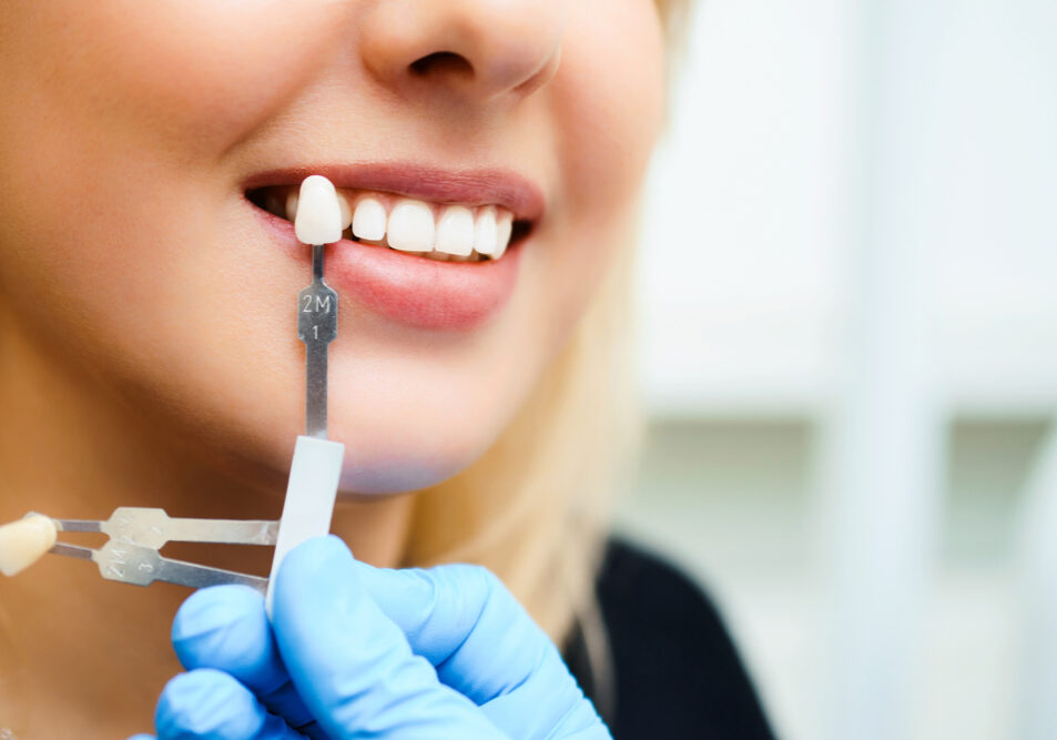 Dentist in Stirling | Beechboro | Joondalup | First Impressions