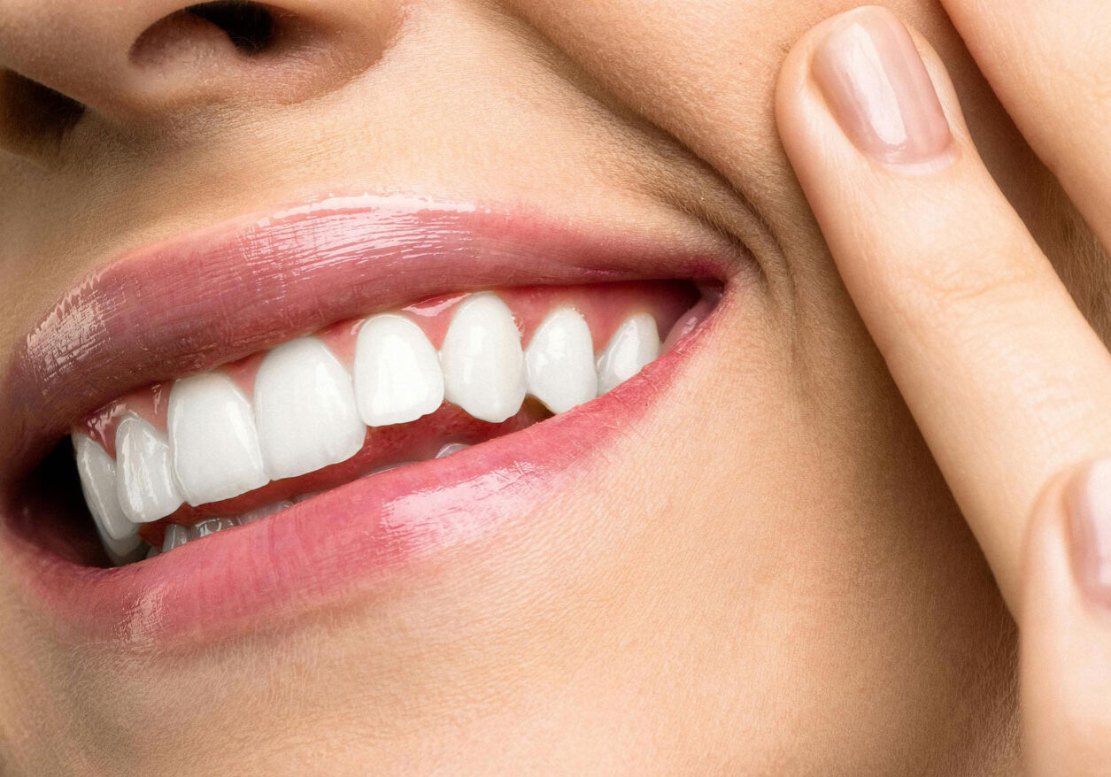 smile-with-zoom-teeth-whitening