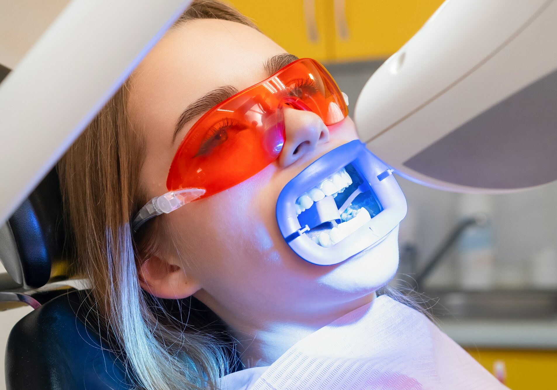UV lamp shines on the patiens teeth during teeth whitening at dentist clinic