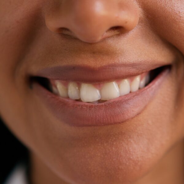 Close-up of a smiling person's mouth and teeth.