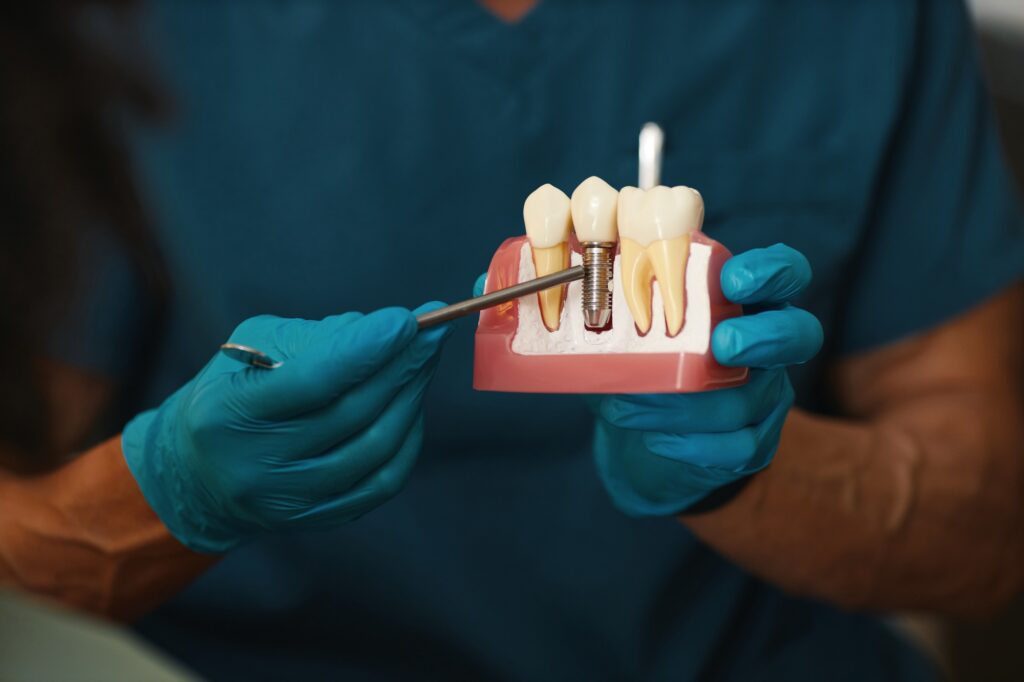 Dentist demonstrating dental implant with model.