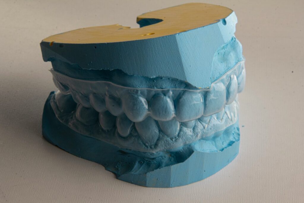 clear Invisalign retainer on a blue mouth mould