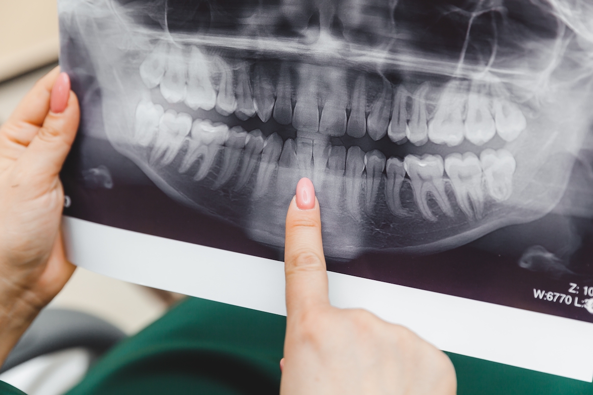 woman holding an x-ray of a patient's set of teeth