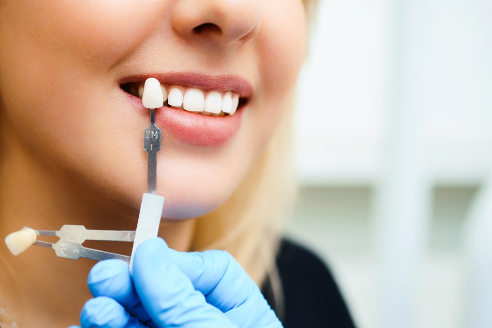 Dentist in Stirling | Beechboro | Joondalup | First Impressions