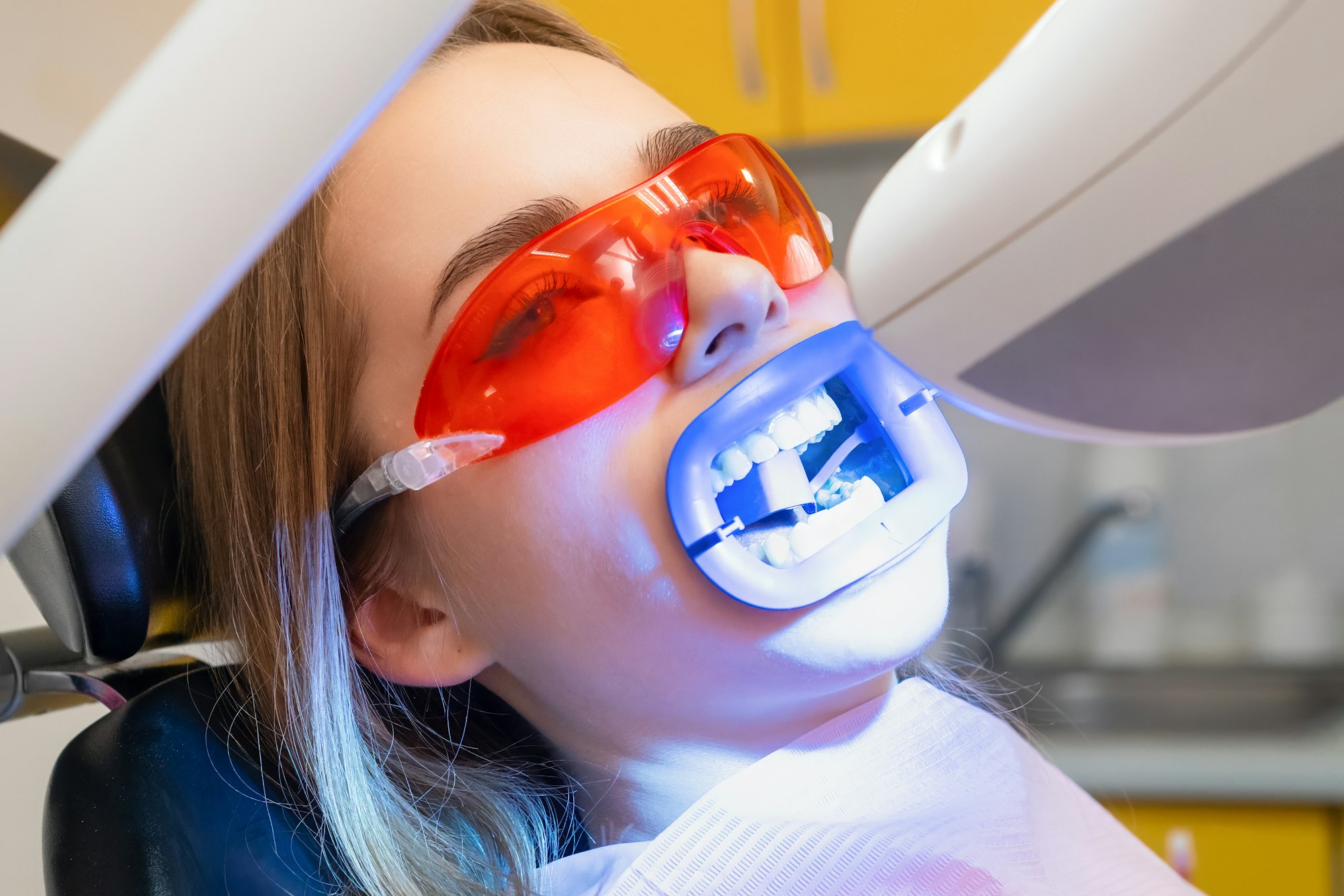 Person receiving teeth whitening treatment at dentist.