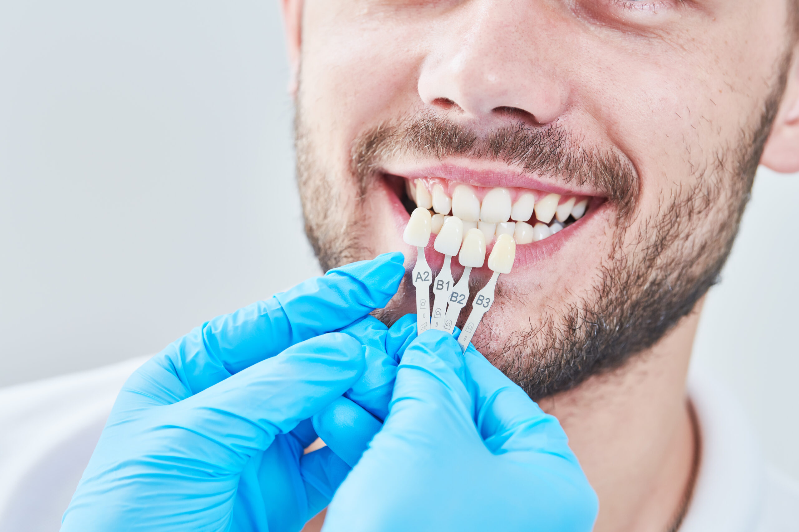 Colour matching Teeth